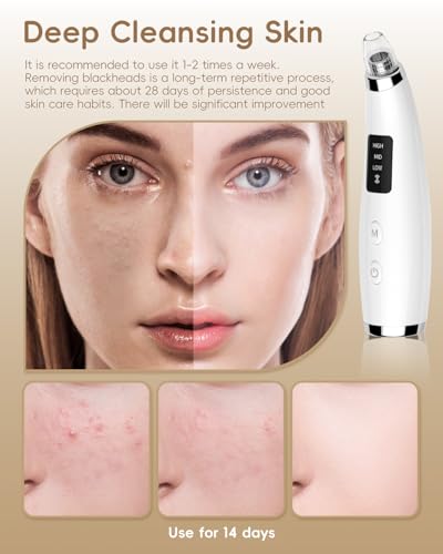 Blackhead Remover Pore Vacuum with 3 Suction Levels 5 Probes