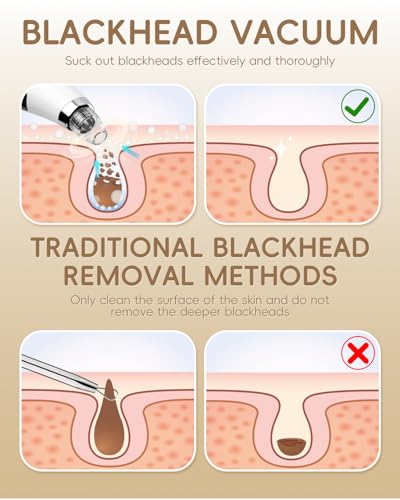 Blackhead Remover Pore Vacuum with 3 Suction Levels 5 Probes