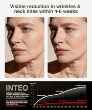 LED Light Mask for Face and Neck with 4 Light Modes 680 LEDs