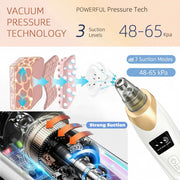 Electric Blackhead Remover 5 Suction Heads 8 Gold Needles USB Rechargeable