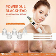 Electric Blackhead Remover 5 Suction Heads 8 Gold Needles USB Rechargeable