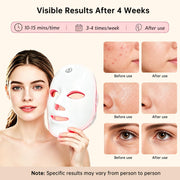7 Color LED Light Therapy Face Mask Red Light Anti Aging Device