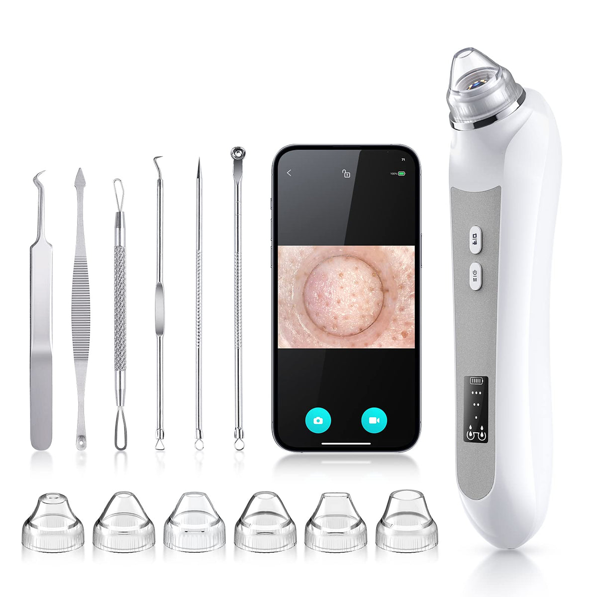 Blackhead Remover Vacuum with Camera 6 Suction Heads USB Rechargeable