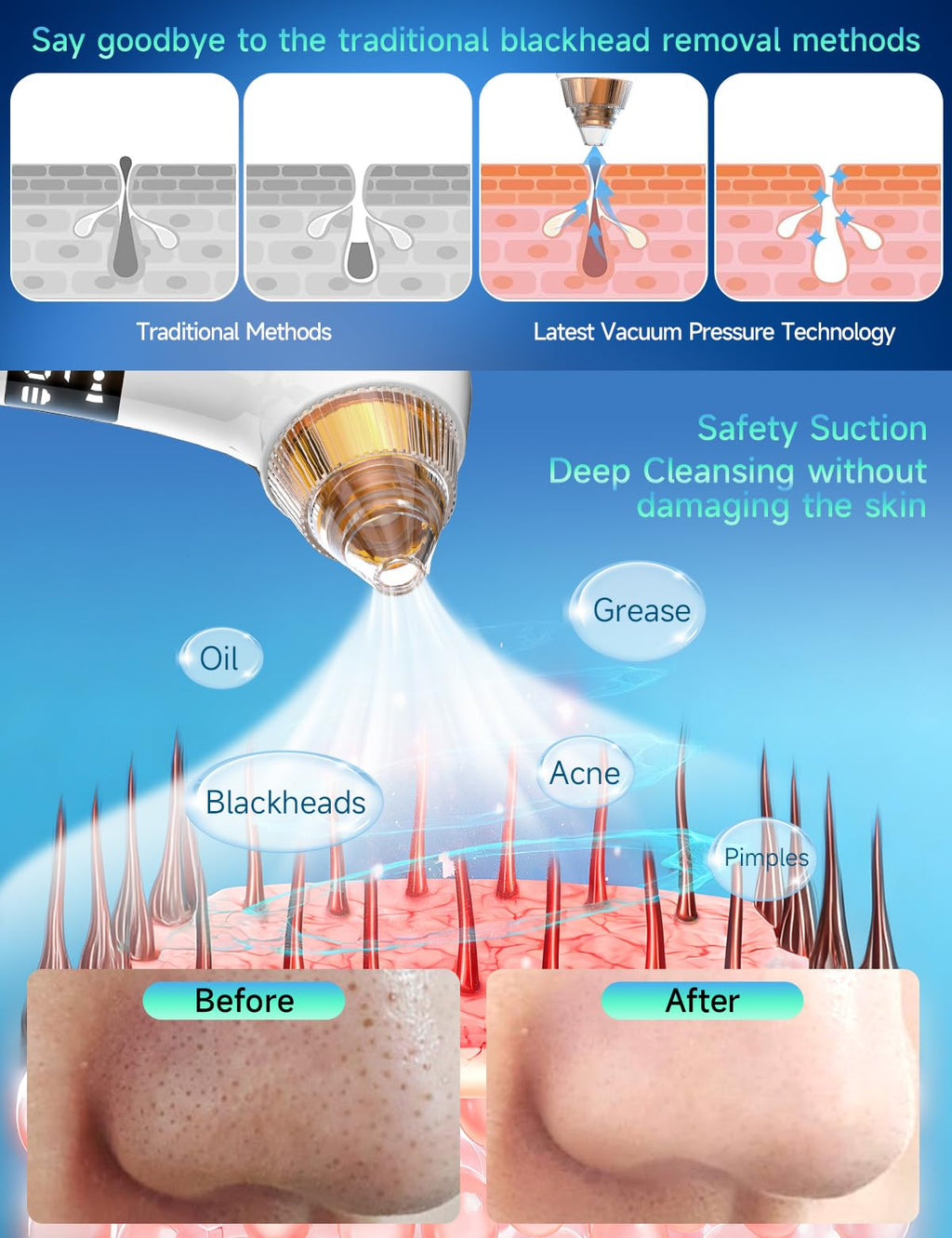 Visible Blackhead Remover Pore Vacuum 6MP Camera 5 Suction Levels