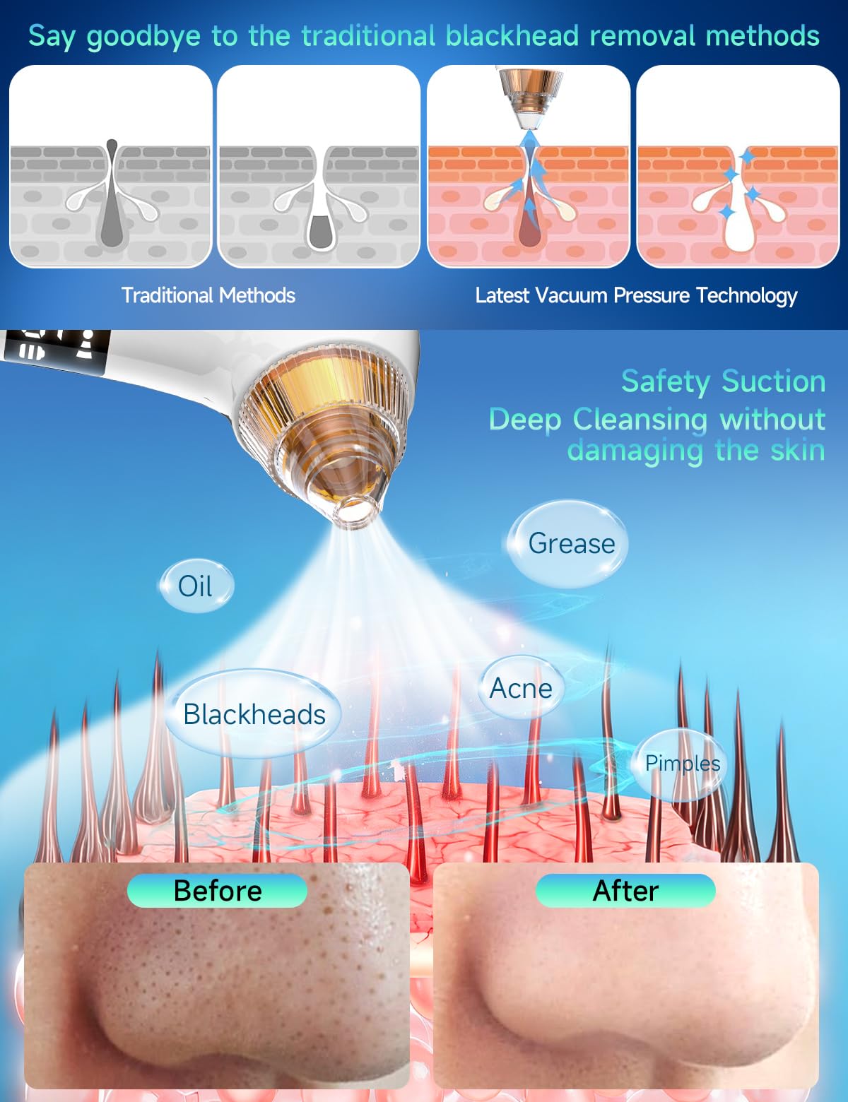 Visible Blackhead Remover Pore Vacuum 6MP Camera 5 Suction Levels