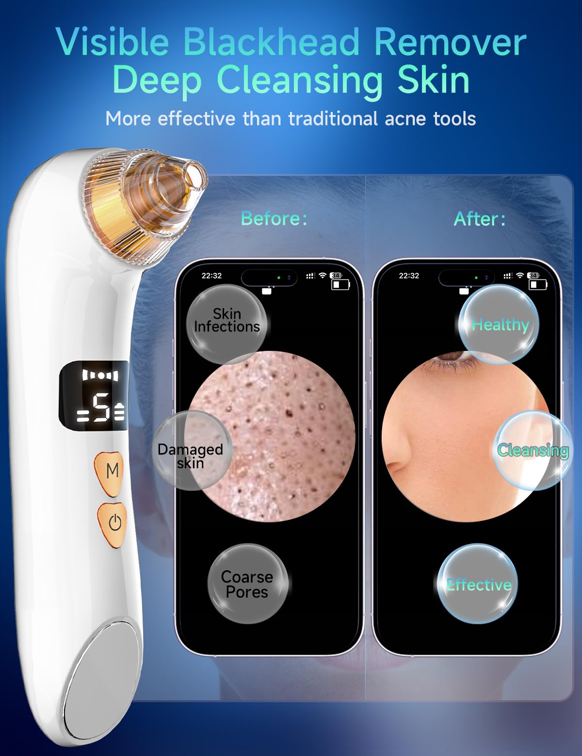 Visible Blackhead Remover Pore Vacuum 6MP Camera 5 Suction Levels