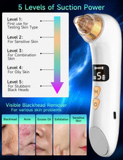 Visible Blackhead Remover Pore Vacuum 6MP Camera 5 Suction Levels