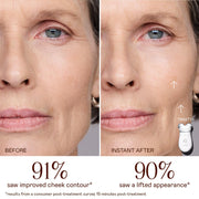 Microcurrent Facial Device Starter Kit