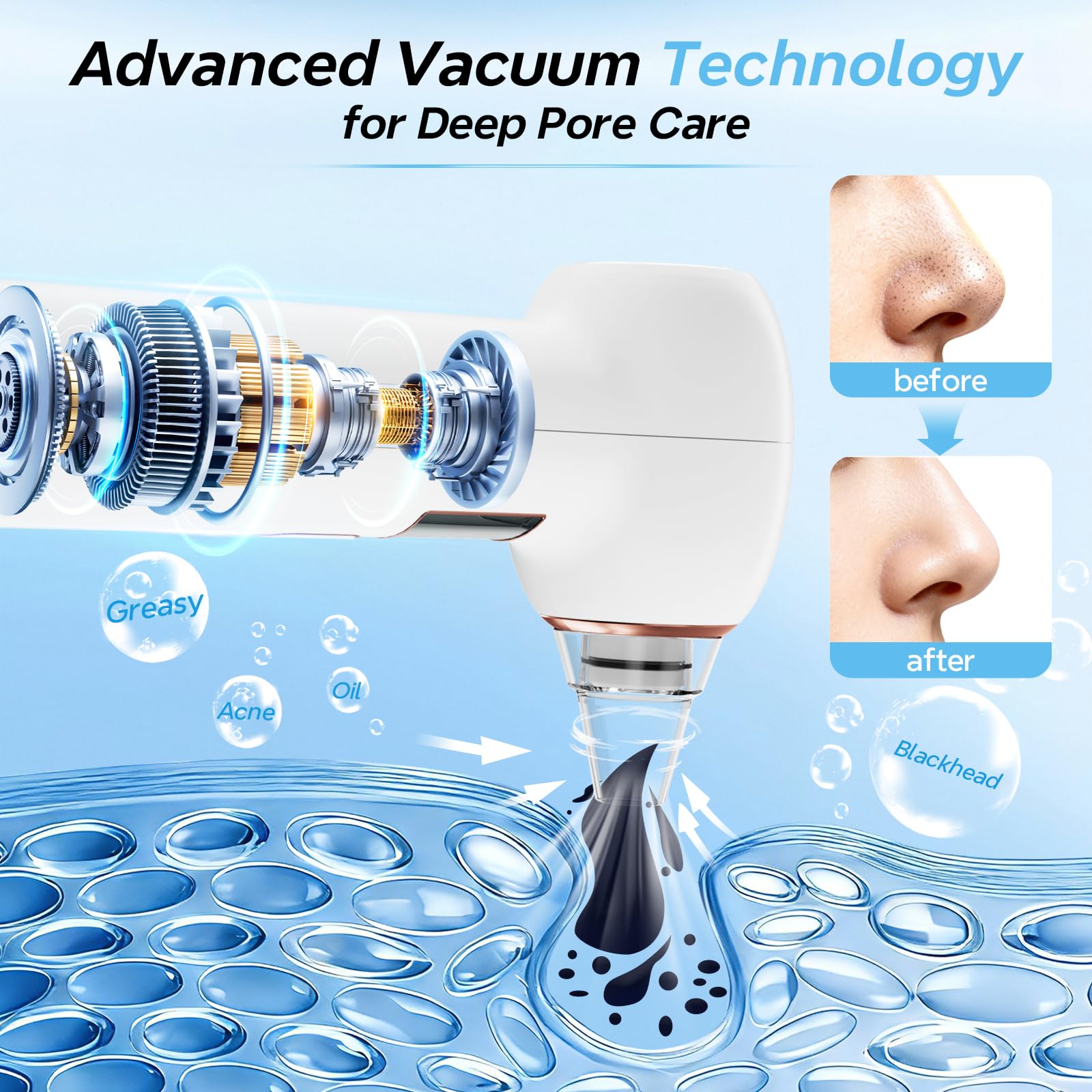 Blackhead Remover Tools Pore Cleansing Devices