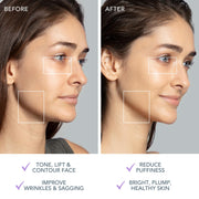 Microcurrent Facial Device Bundle with Serum Moisturizer
