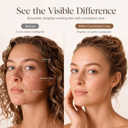 Dual Probe Facial Device for Lifting Tightening and Skin Renewal